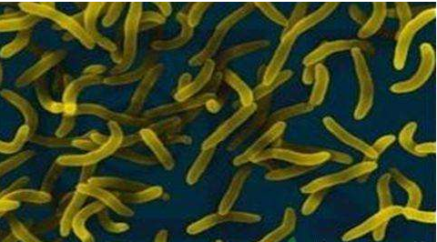 微生物菌劑好？好在哪里您知道嗎？